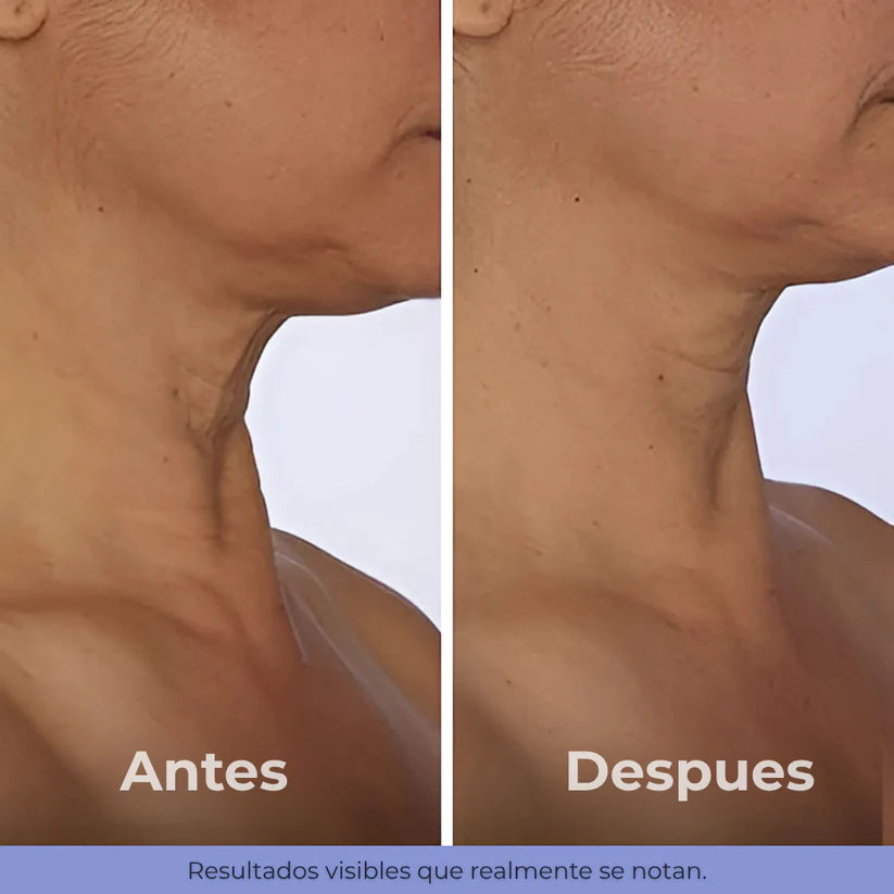 GoPure® Reafirmante de Cuello y Escote – Firmeza visible | Hasta 75% OFF + Envío GRATIS